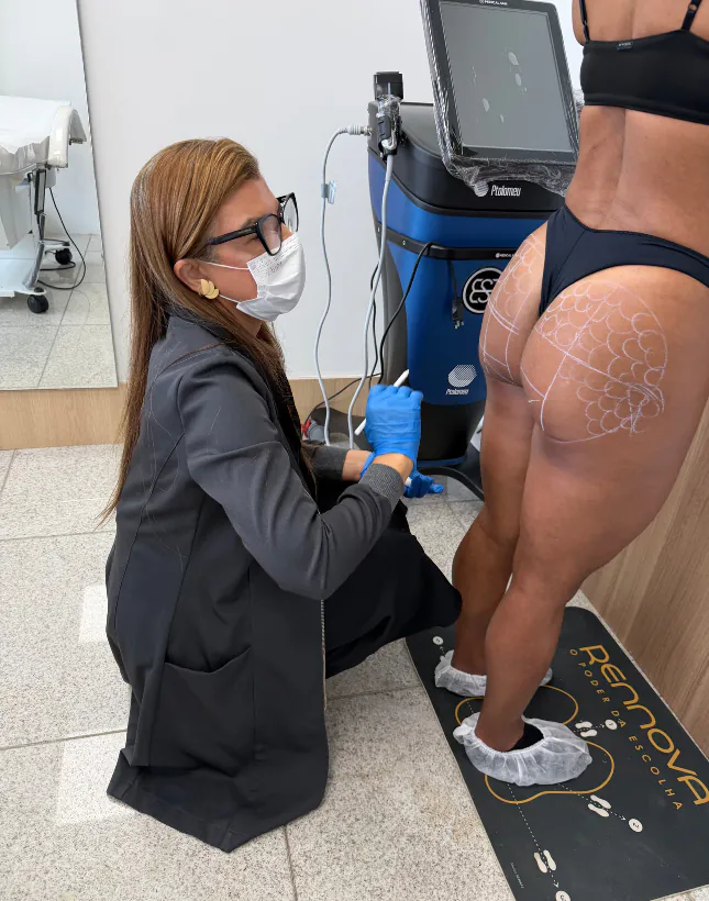 Dra. Maravilhosa realizando harmonização glútea pelo método GOLD BUTT